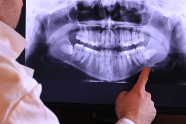 Best Emergency Dental Care for Broken or Chipped Teeth in New Madrid, MO
