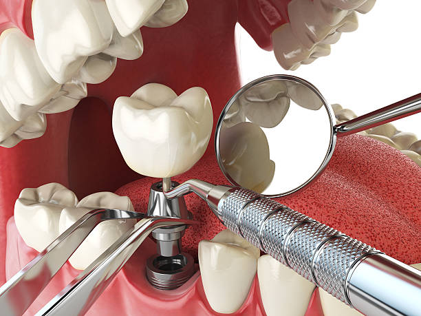 Best Cosmetic Emergency Dentistry in New Madrid, MO